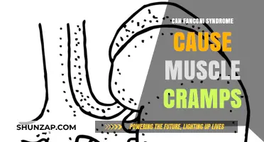 Fanconi Syndrome: Muscle Cramps and Their Link