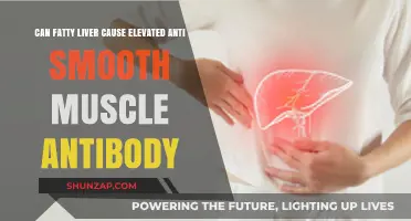 Fatty Liver and Anti-Smooth Muscle Antibody: Is There a Link?
