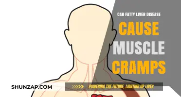 Fatty Liver Disease: Muscle Cramps and Their Link