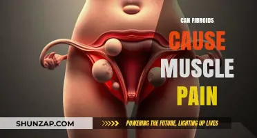 Fibroids and Muscle Pain: What's the Link?