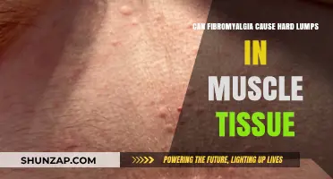 Fibromyalgia and Hard Lumps: What's the Connection?