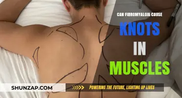 Fibromyalgia: Muscle Knots and Their Causes