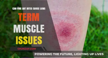 Fire Ant Bites: Long-Term Muscle Complications?