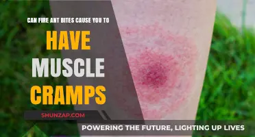Fire Ant Bites: The Surprising Cause of Muscle Cramps?