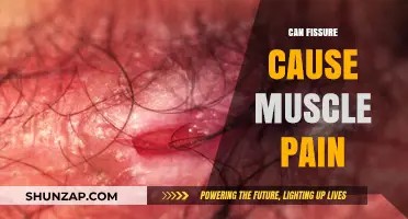 Fissure-Related Muscle Pain: What's the Link?
