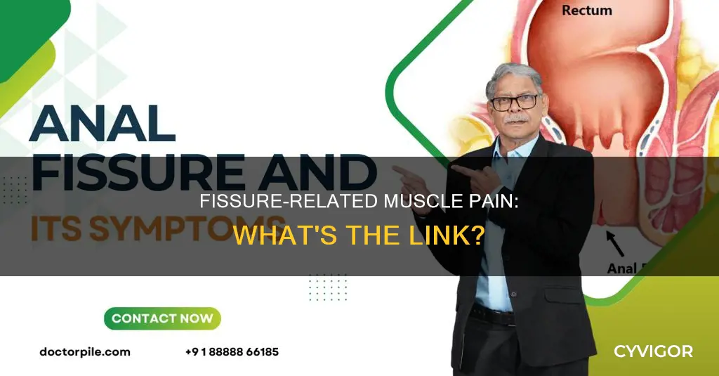 can fissure cause muscle pain