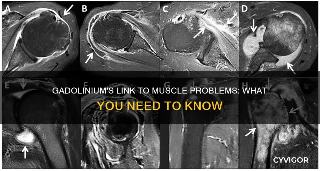 can gadolinium cause muscle problems