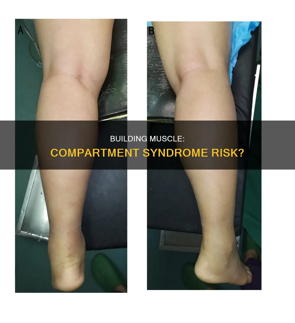 can gaining muscle cause compartment syndrome