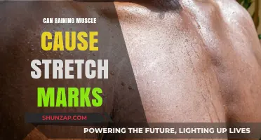 Building Muscle: Stretch Marks, Causes and Prevention