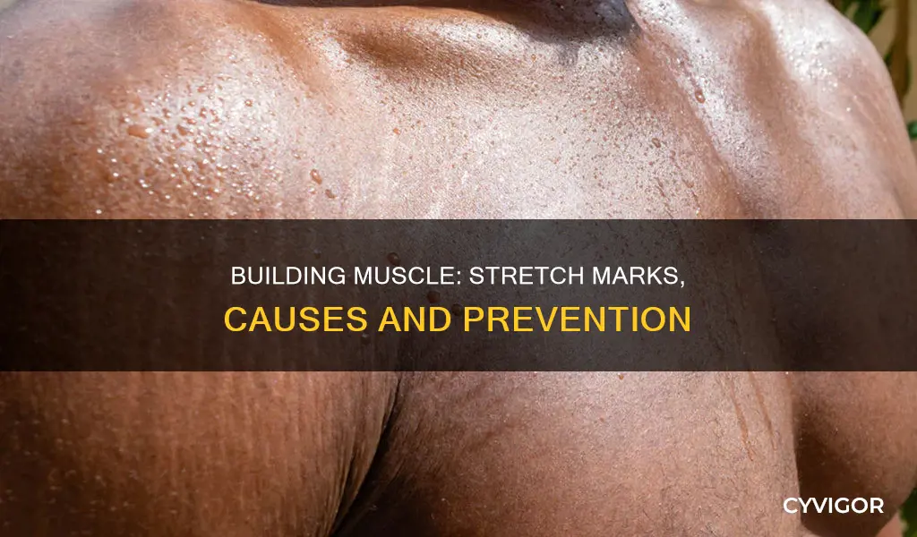 can gaining muscle cause stretch marks