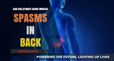 Gallstones and Back Spasms: Is There a Link?