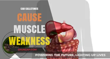 Gallstones and Muscle Weakness: Is There a Link?