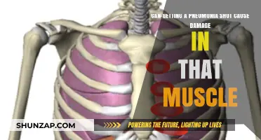 Pneumonia Shot: Muscle Damage or Myth?