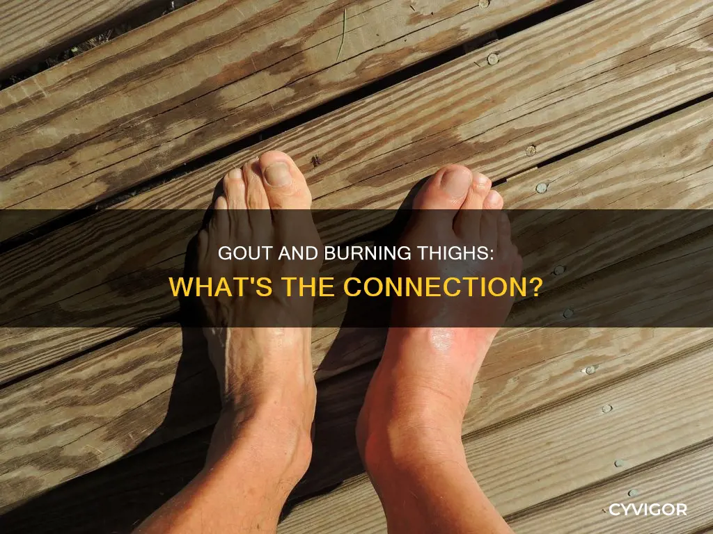 can gout cause a burning feeling in thiegh muscles