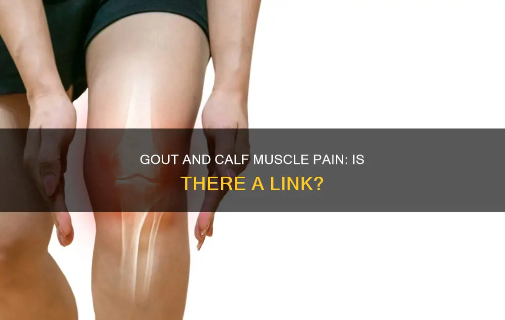 can gout cause calf muscle pain
