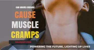 Graves' Disease: Muscle Cramps and Their Connection