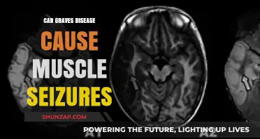 Graves' Disease: Muscle Seizures and Their Connection