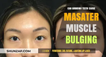Teeth Grinding: Can It Cause Masseter Muscle Bulging?