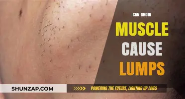 Groin Muscle Lumps: What You Need to Know