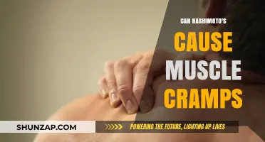 Hashimoto's and Muscle Cramps: Is There a Link?
