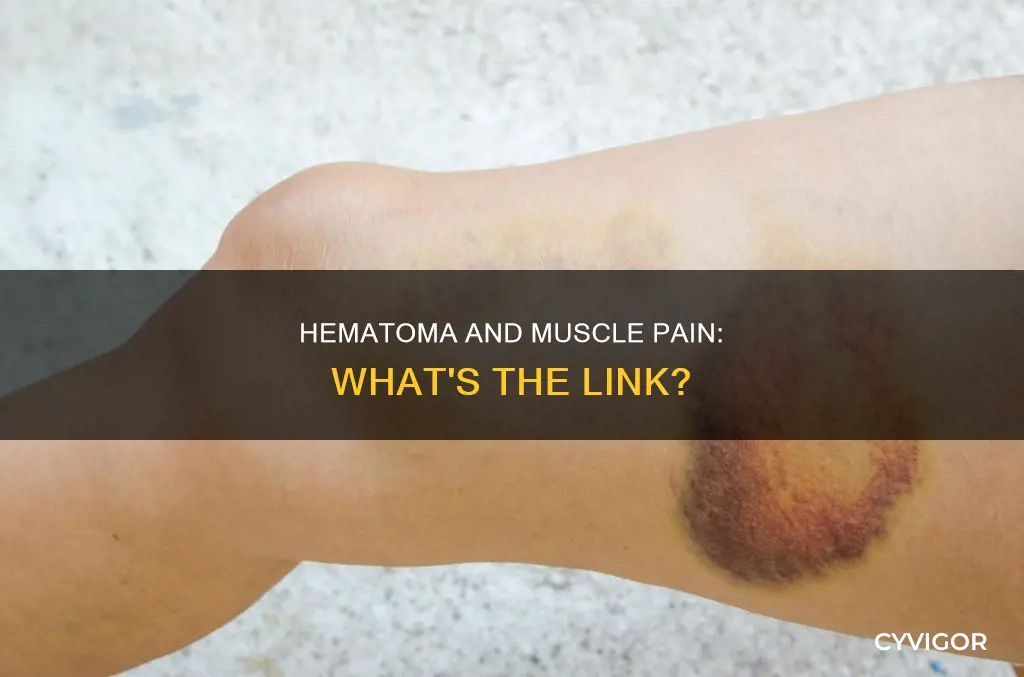 can hematoma cause muscle pain