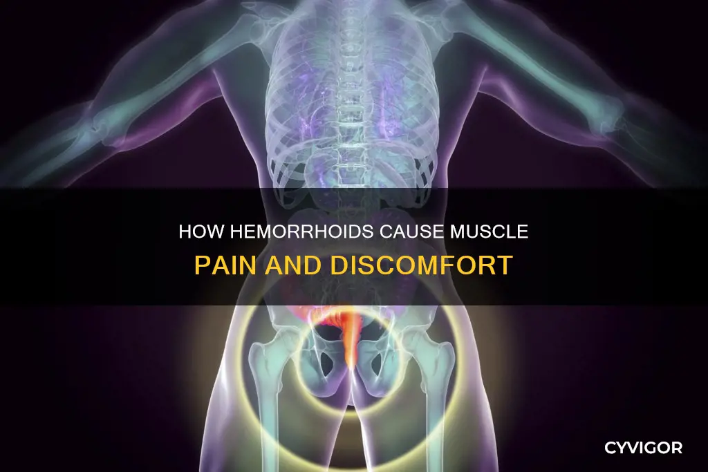 can hemorrhoids cause muscle pain