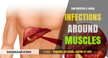 Hepatitis C: Muscle Infections and Their Link