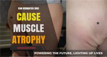 Herniated Discs: Muscle Atrophy and Degeneration