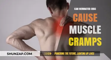 Herniated Discs and Muscle Cramps: What's the Connection?