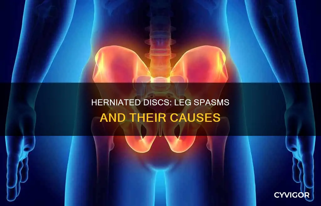 can herniated disc cause muscle spasms in legs