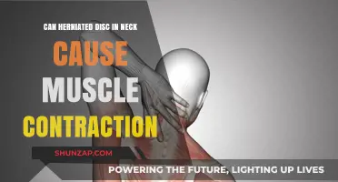 Neck Herniated Disc: Muscle Contraction Connection