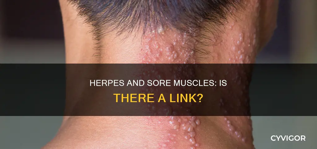 can herpes cause sore muscles