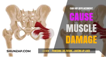 Hip Replacement: Muscle Damage Risk and Recovery