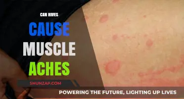 Hives and Muscle Aches: What's the Connection?
