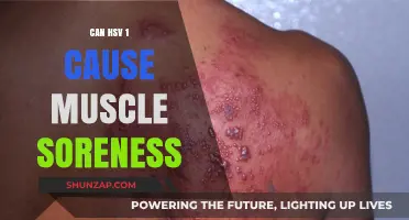 How HSV-1 Triggers Muscle Soreness