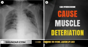 Hydrocodone's Impact: Muscle Deterioration and You