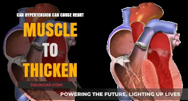 Hypertension's Impact: Thickened Heart Muscle and Cardiomyopathy