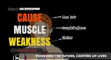 Hyperthyroidism and Muscle Weakness: Is There a Link?
