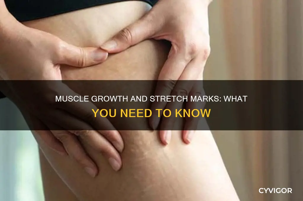 can i get stretch marks from gaining muscle