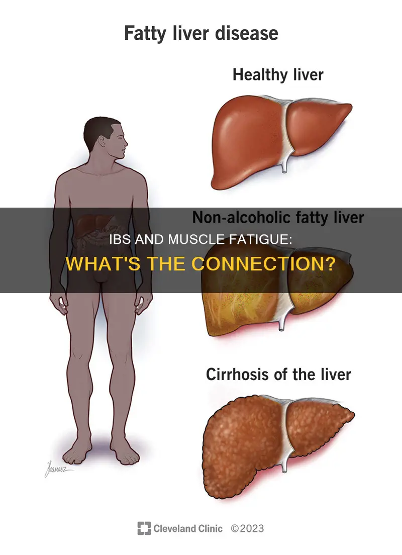can ibs cause muscle fatigue