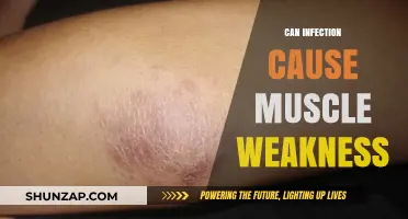Infection-Linked Muscle Weakness: What's the Connection?