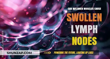 Muscle Inflammation and Swollen Lymph Nodes: What's the Link?