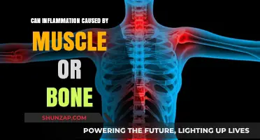 Inflammation: Understanding Muscle and Bone Pain