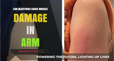 Injections: Arm Muscle Damage Risk?