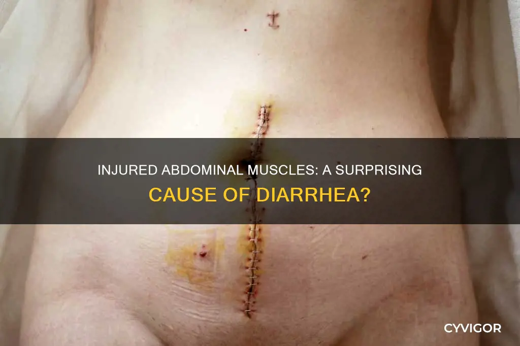 can injured abdominal muscles cause diarrhea