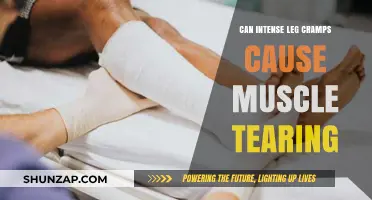 Leg Cramps: When Do They Signal Muscle Tears?