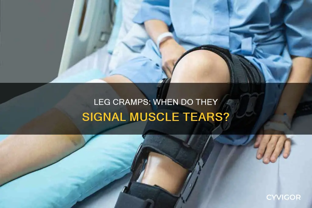can intense leg cramps cause muscle tearing