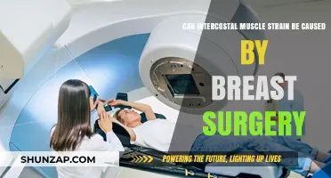 Breast Surgery: Can It Strain Intercostal Muscles?