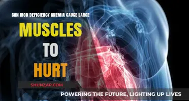 Iron Deficiency Anemia: The Link to Muscle Pain