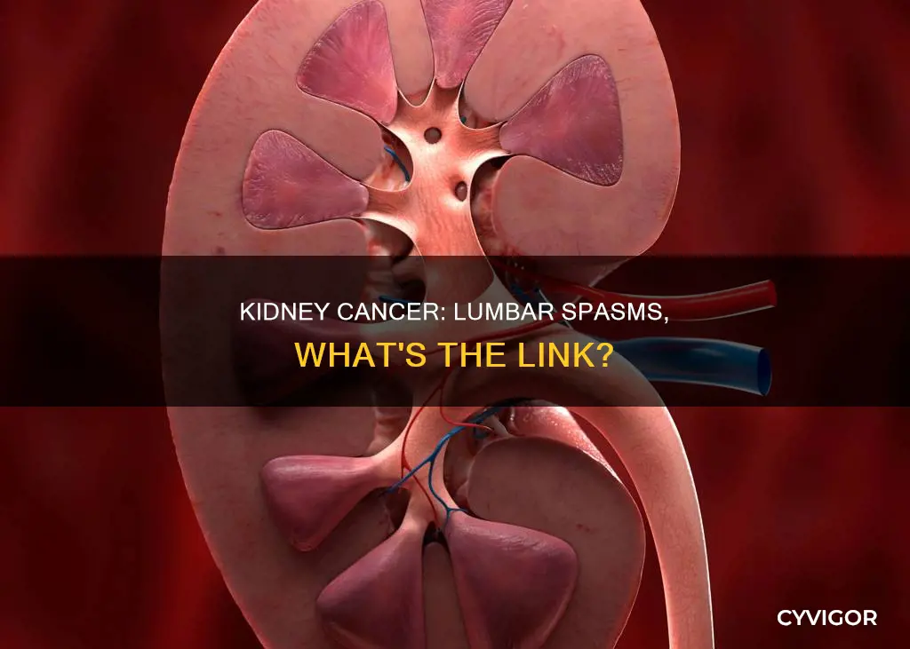 can kidney cancer cause lumbar muscle spasms